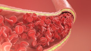 supporting image for Unit 1.4: Circulatory system in humans - Blended learning